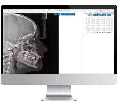 Software para clínicas de radiologia. PACS HIS RIS ERP. Software radiologia